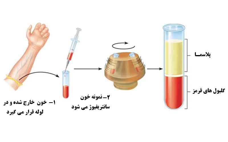 مراحل انجام پی آر پی صورت در کلینیک نوبلا