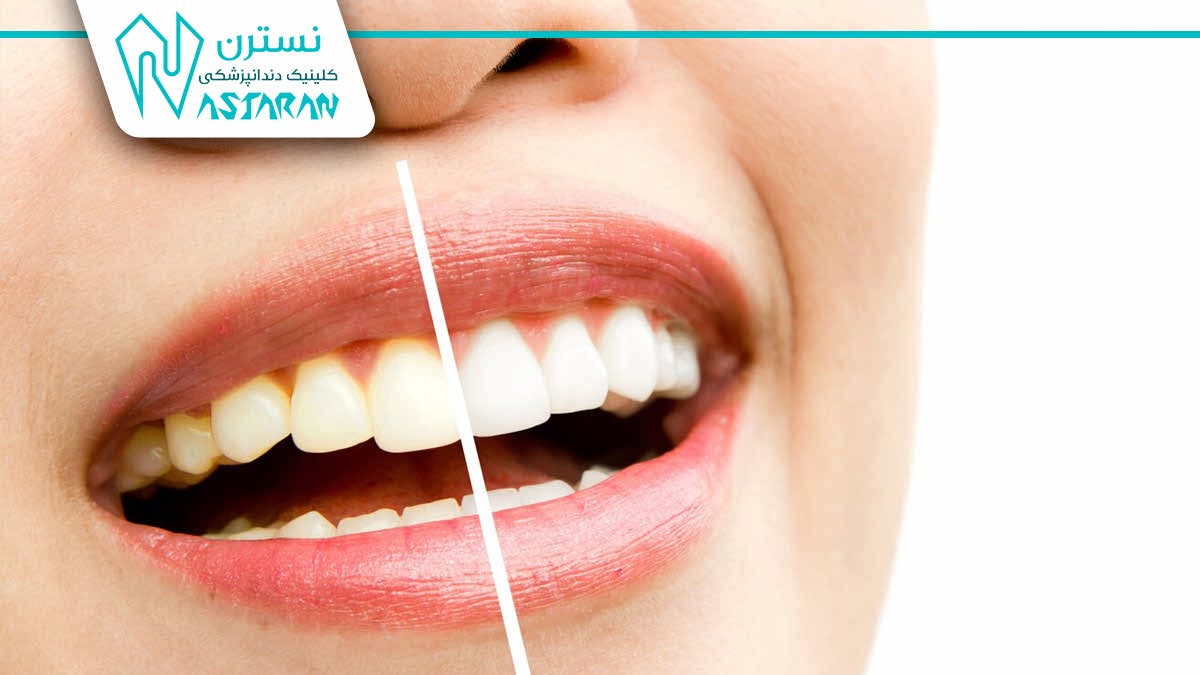 تعرفه خدمات دندانپزشکی 1404