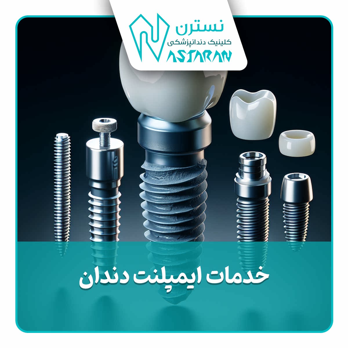 قیمت ایمپلنت دندان