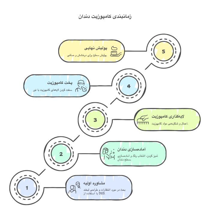 زمان مورد نیاز برای کامپوزیت دندان