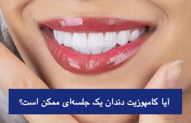 آیا کامپوزیت دندان یک جلسه‌ای ممکن است؟ راهنمای کامل