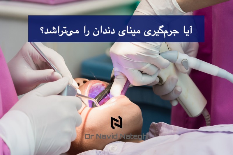 درمان جرم دندان بدون آسیب به مینا