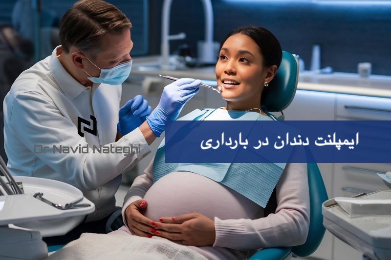 ایمپلنت دندان در بارداری : راهنمای جامع، نکات ایمنی و بهترین زمان