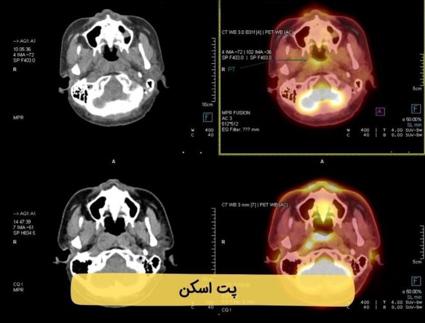 تفاوت پت اسکن و سی‌تی اسکن ؛ بررسی کامل دو روش مهم تصویربرداری پزشکی